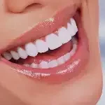 العناية بالأسنان