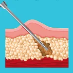 مذيب دهون ومذيب فلر