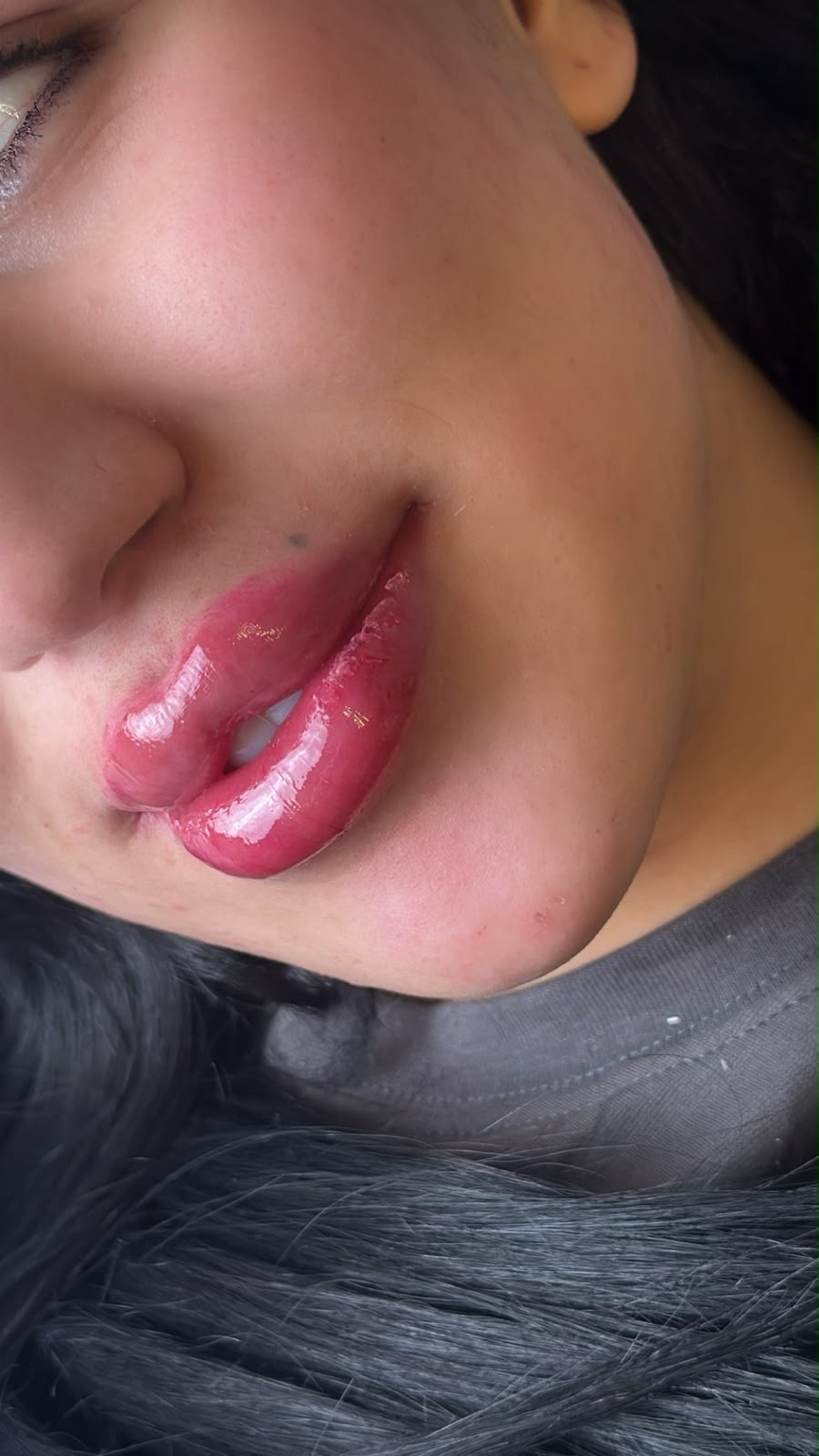 thumb