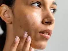 thumb image