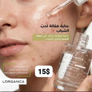 سيروم  لحبّ الشباب