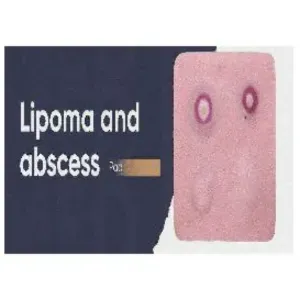Lipoma and abscess pad
