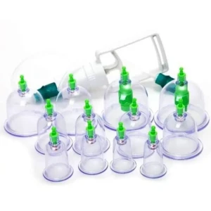 كاسات حجامة