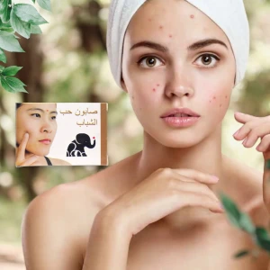 صابون حب الشباب