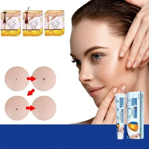 مرهم ازالة الزوائد والثأليل