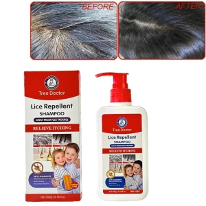 شامبو د.تري لمحاربة القشره