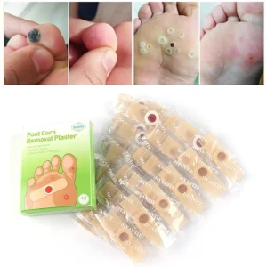 لاصقات علاج مسامير اللحم الحجم الكبير 42 لاصق